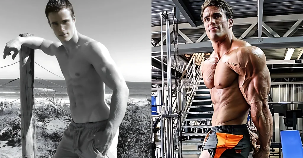Calum Von Moger Bodybuilder Then And Now