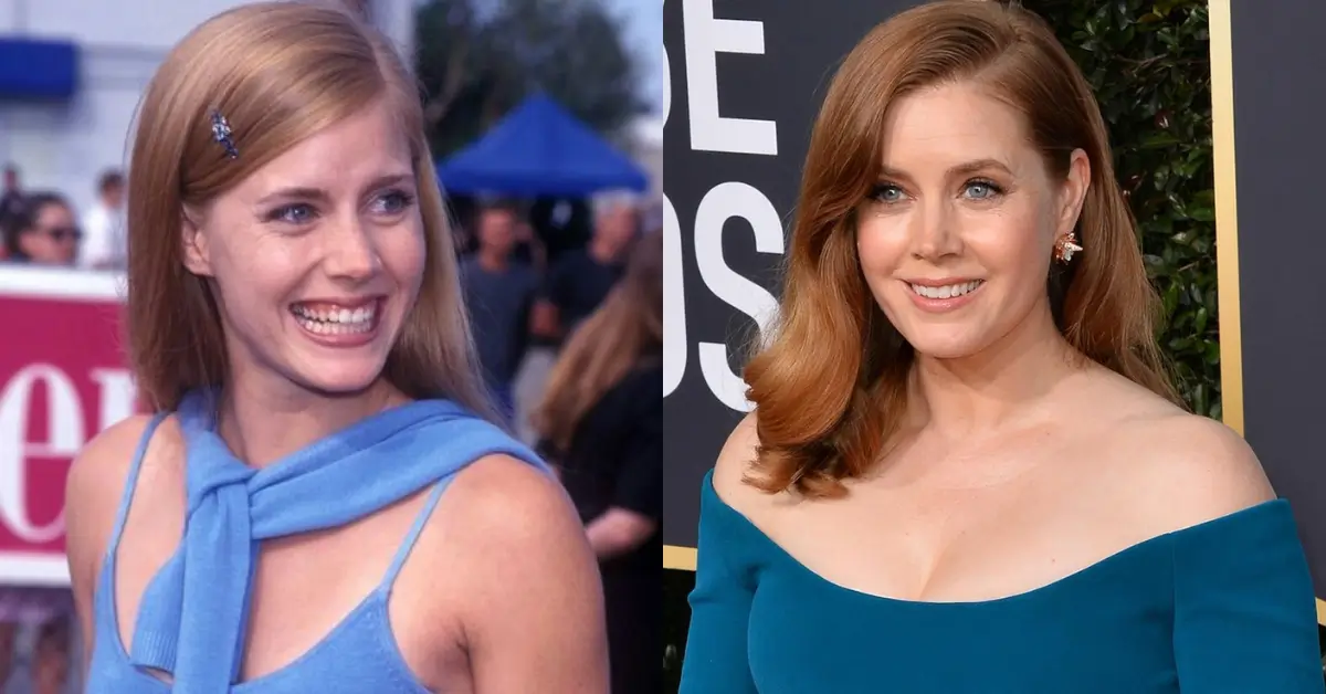 Amy Adams Then and Now