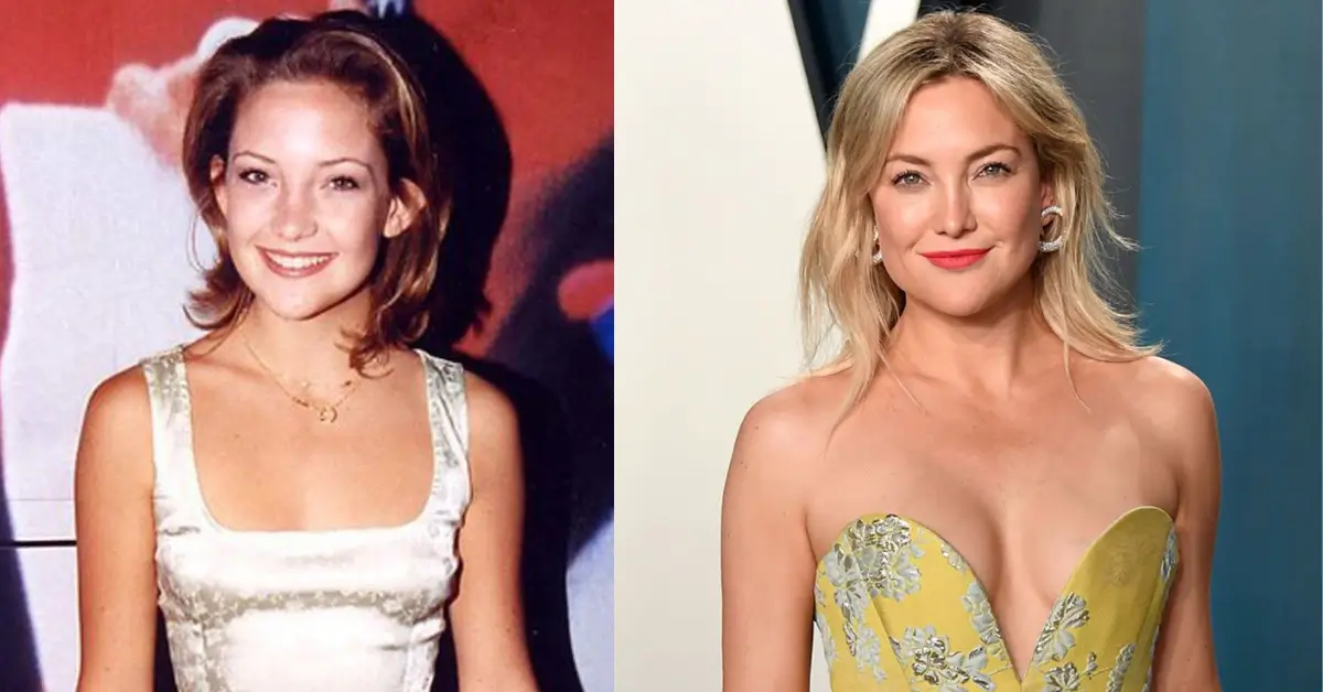 Kate Hudson Then and Now