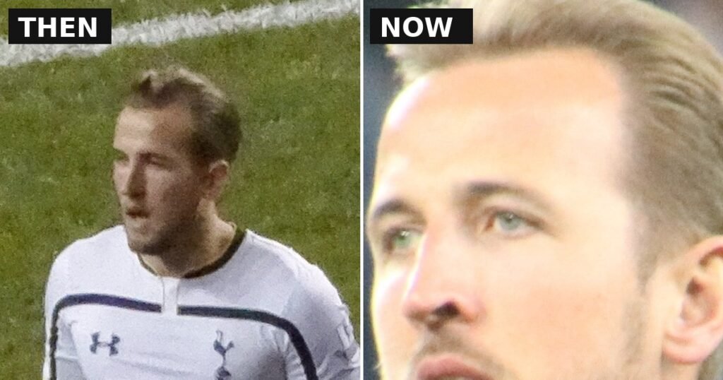 Harry Kane then and now comparison