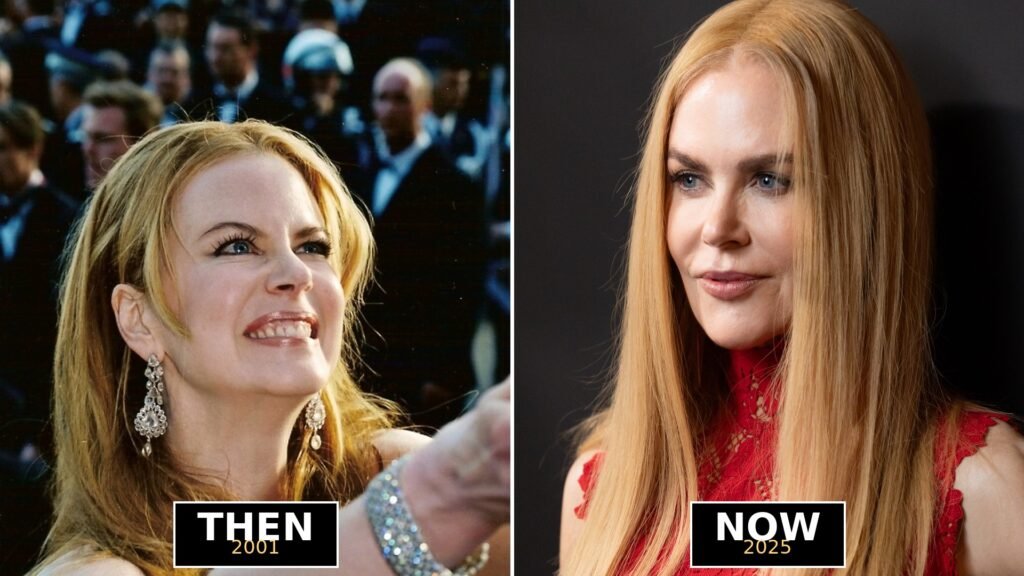 Nicole Kidman then and now, 2001 and 2025